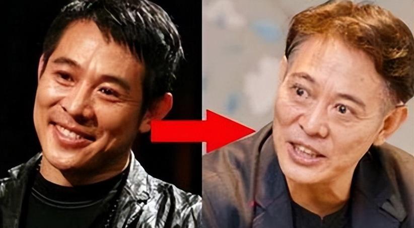 明星病痛_女明星生理缺陷_冯小刚白斑